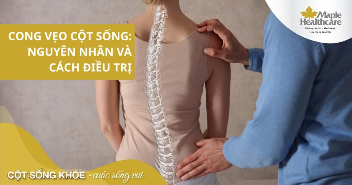 Cong vẹo cột sống: Nguyên nhân và cách điều trị hiệu quả