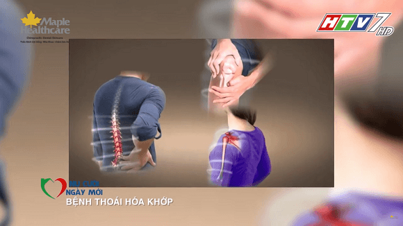 những biến chứng khi không điều trị thoái hóa khớp kịp thời