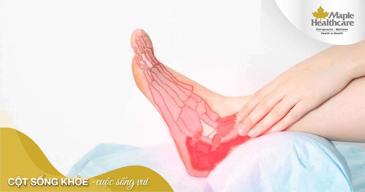 Giãn dây chằng - Triệu chứng, nguyên nhân và cách điều trị