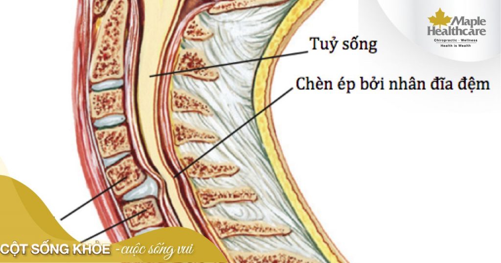 Chèn là gì? Giải thích đầy đủ, ví dụ, cách sử dụng và bài tập ngữ pháp