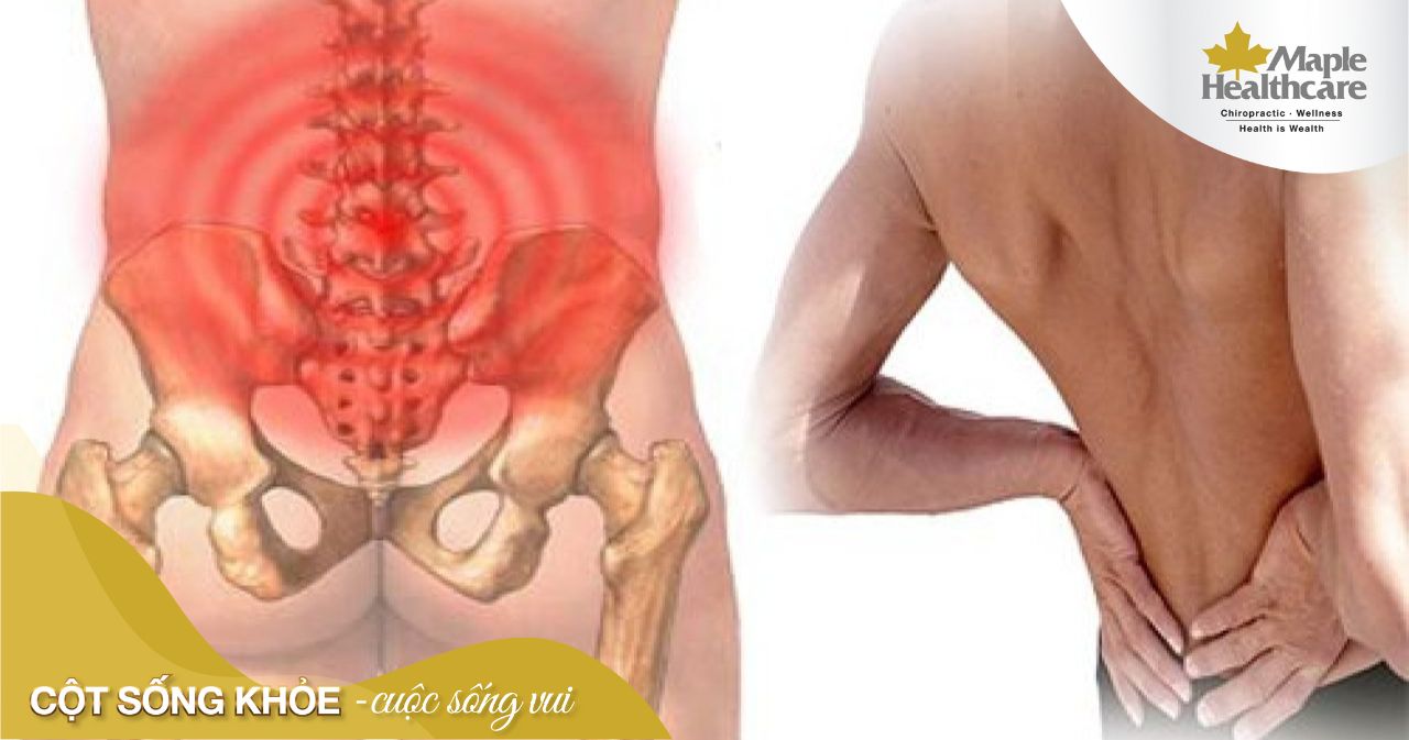 Tìm hiểu về lệch xương chậu là gì?