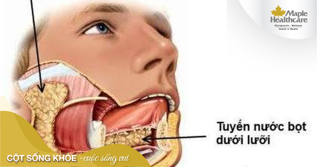 Viêm tuyến nước bọt dưới lưỡi