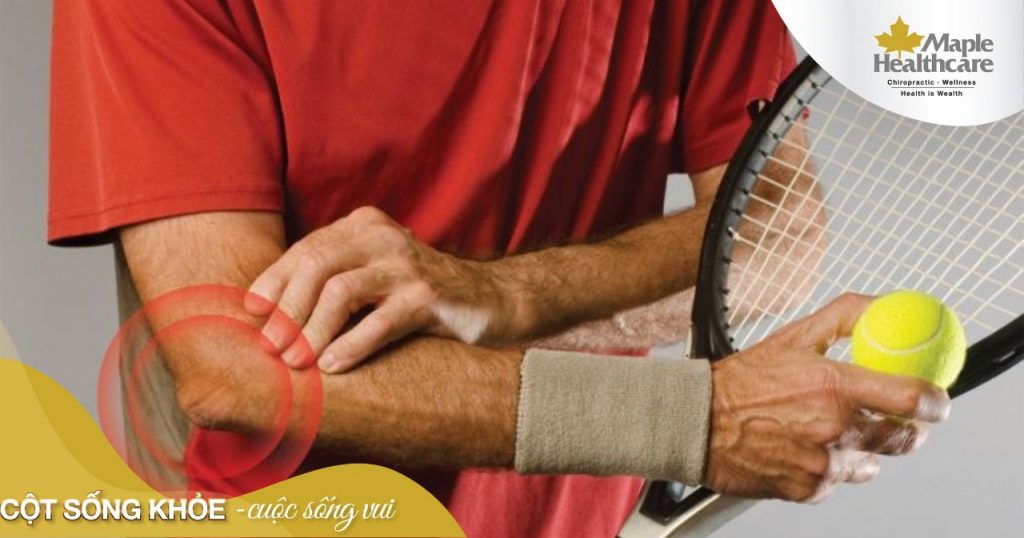 Hội chứng Tennis Elbow là gì và có thể điều trị được không?