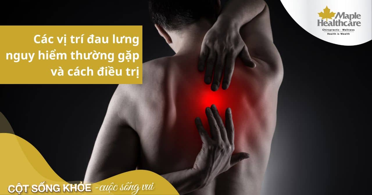 Các Vị Trí Đau Lưng: Nguyên Nhân và Cách Điều Trị Hiệu Quả