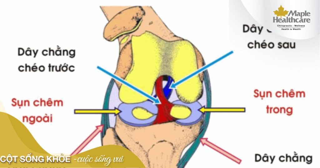 Vỡ sụn chêm đầu gối là như thế nào?