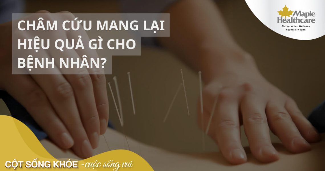 Châm cứu mang lại hiệu quả gì cho bệnh nhân