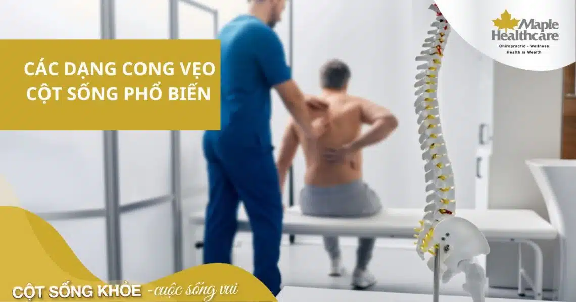 Các dạng cong vẹo cột sống thường gặp, dạng nào nguy hiểm nhất