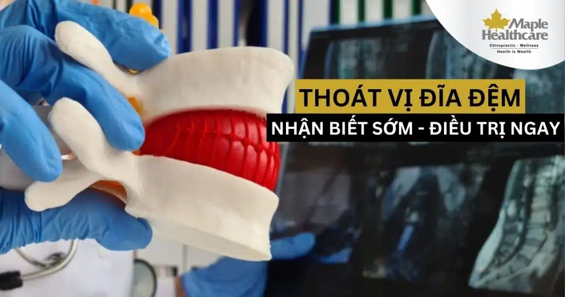 Thoát vị đĩa đệm là gì? Phương pháp nào điều trị hiệu quả?