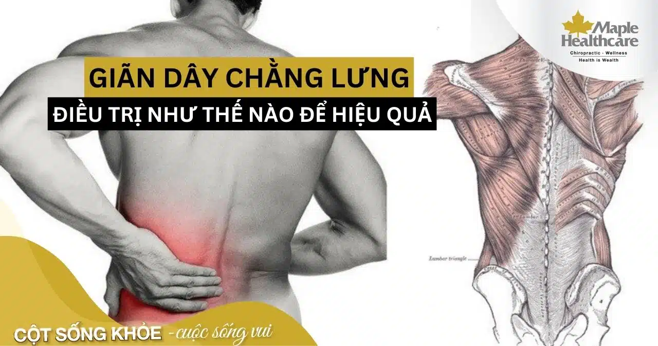 Giãn dây chằng lưng điều trị như thế nào để hiệu quả