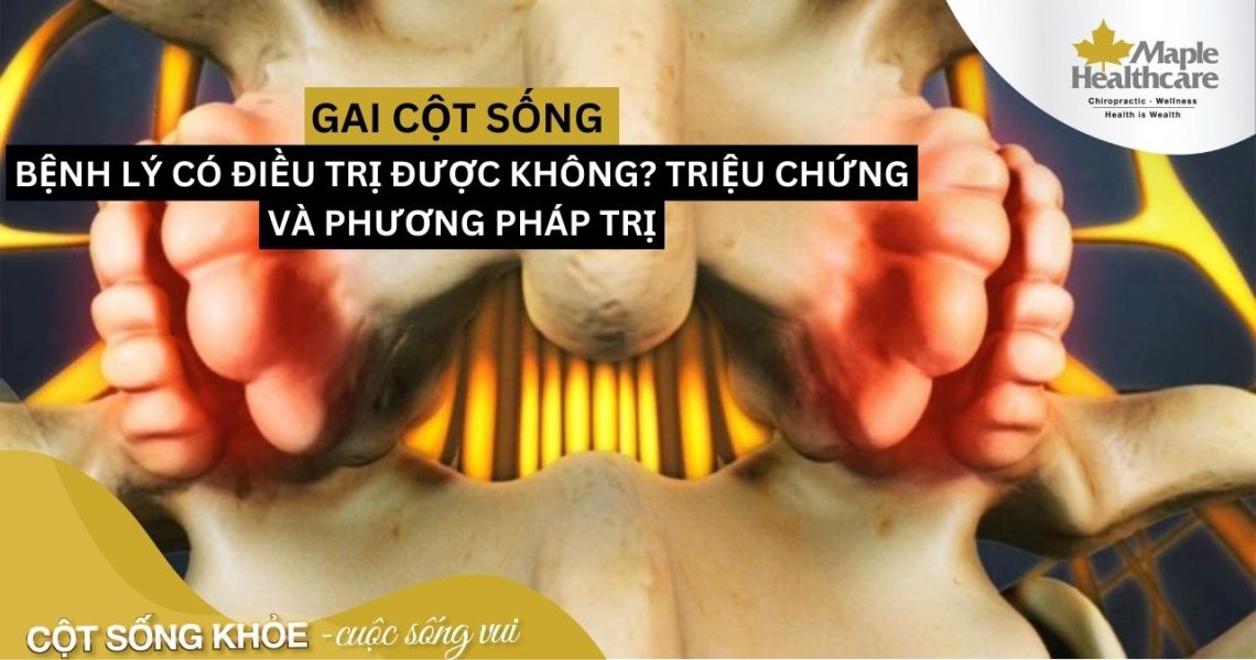 Gai cột sống có thể điều trị được không? Nguyên nhân và các triệu chứng của bệnh