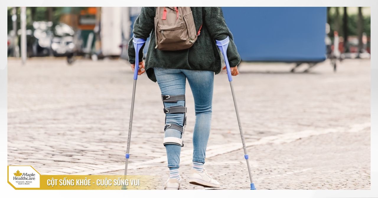 Các phải pháp phục hồi chức năng