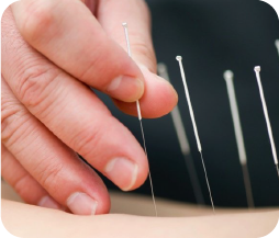 Hình ảnh châm cứu trị liệu