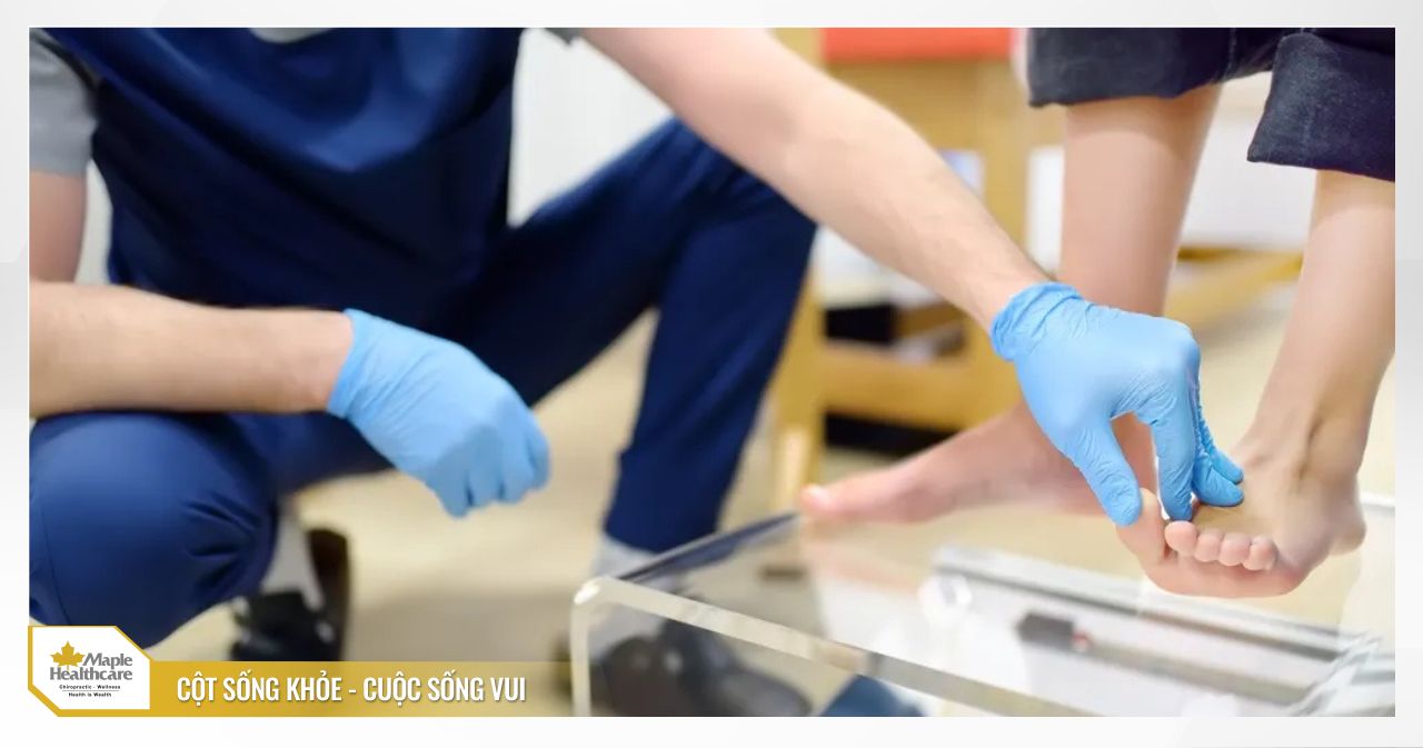 Bàn chân bẹt là gì