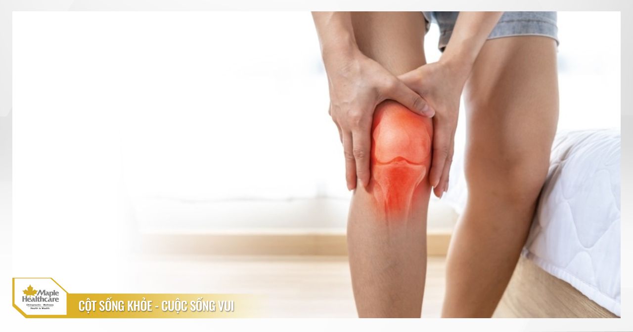 Biến chứng thoái hóa khớp gối từ nguyên nhân bàn chân bẹt