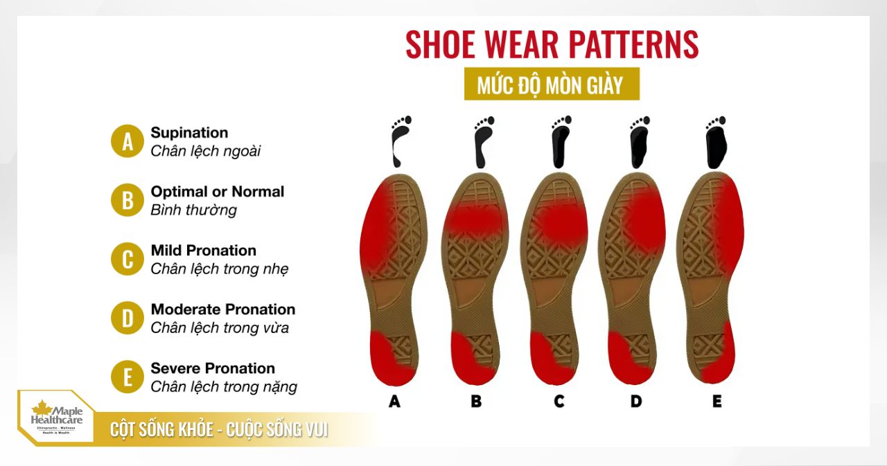 Kiểm tra vết mòn đế giày 