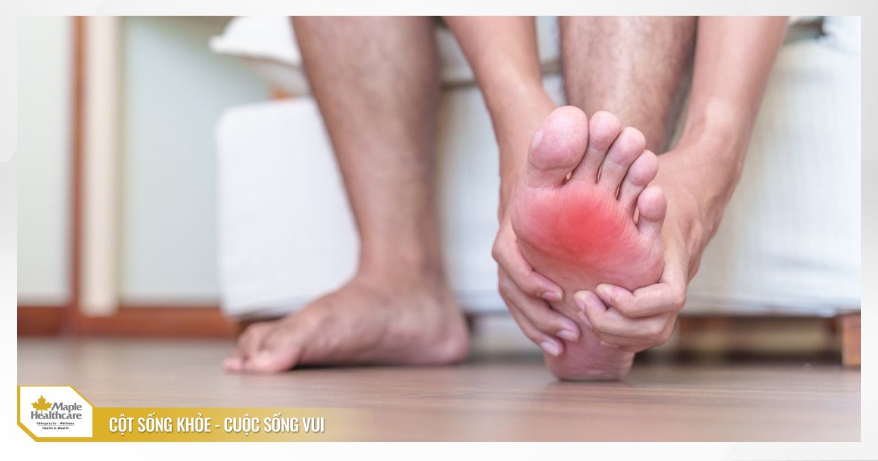 Đau mỏi ở lòng bàn chân là dấu hiệu bàn chân bẹt thường gặp