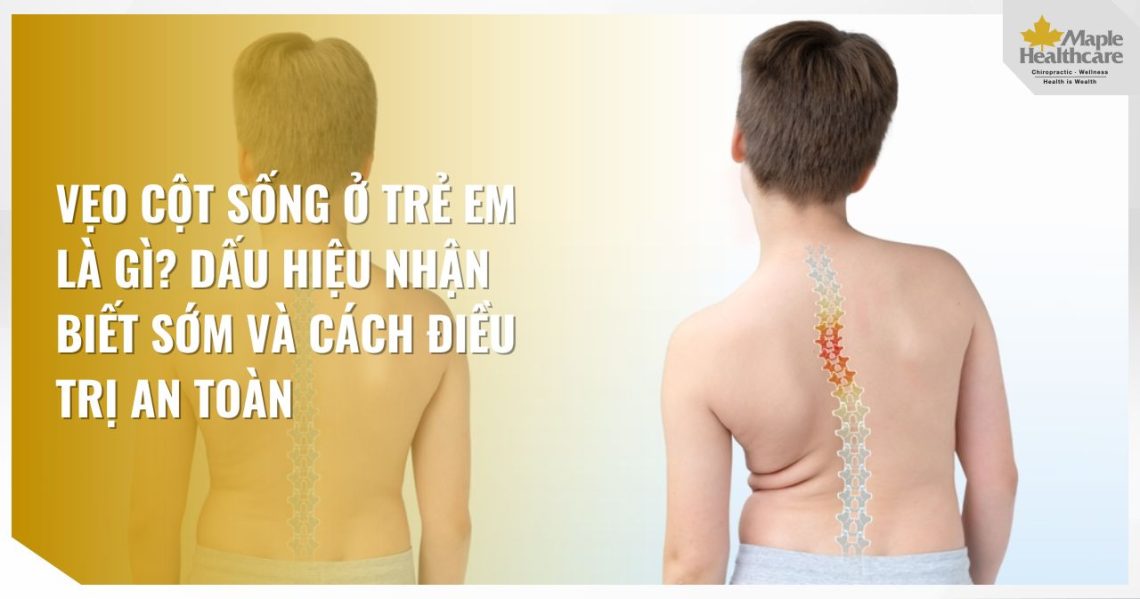 Vẹo cột sống ở trẻ em là gì? Dấu hiệu nhận biết sớm và cách điều trị an toàn