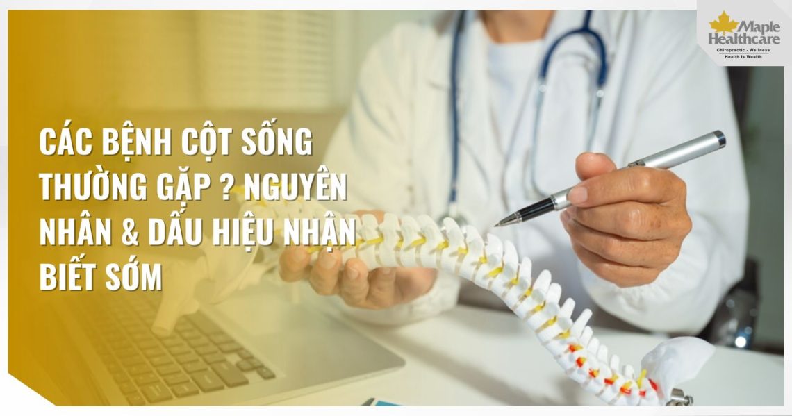 Các Bệnh Cột Sống Thường Gặp Nhất