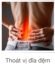 Thoat-vi-dia-dem-promotion-d3 Thoát vị đĩa đệm promotion