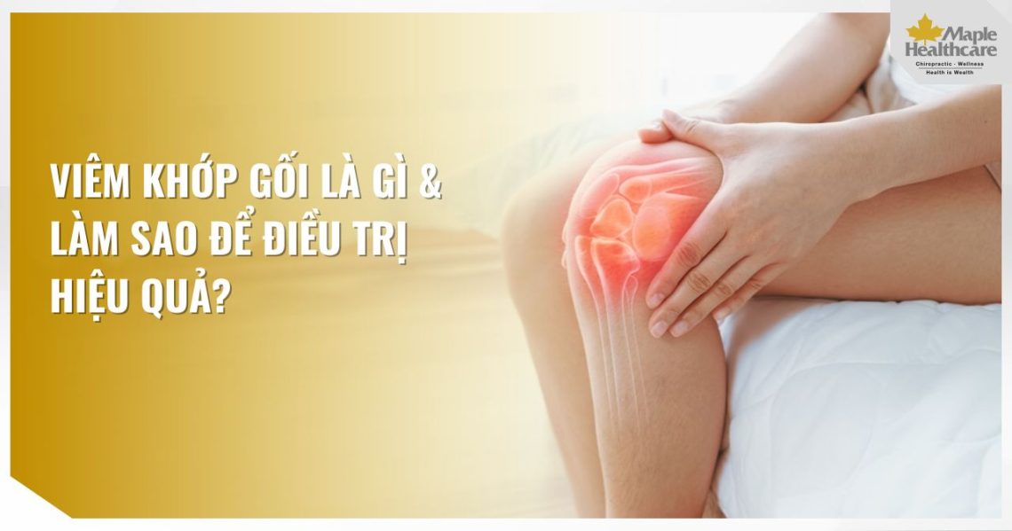 Viêm khớp gối là gì và làm sao để điều trị hiệu quả?