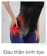 dau-than-kinh-toa-promotion Đau thần kinh tọa promotion