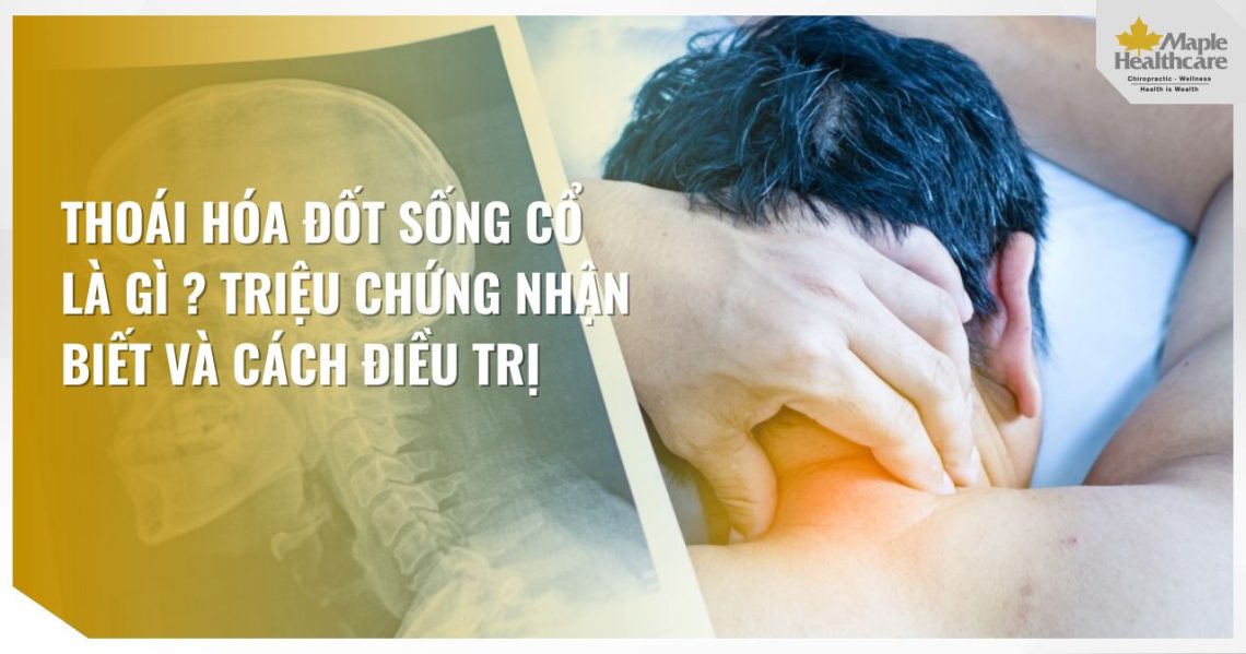 Thoái hóa đốt sống cổ là gì