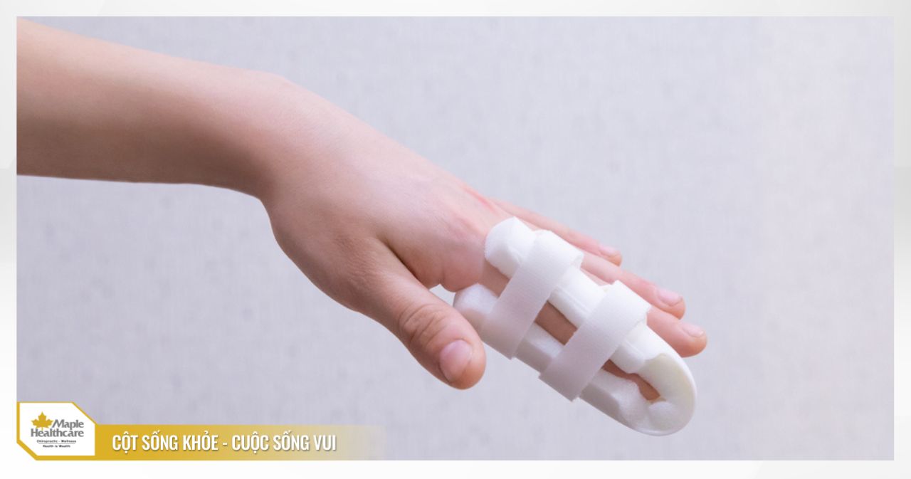 Nẹp ngón tay lò xo