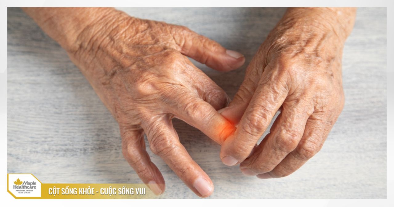 Thoái hóa khớp ngón tay