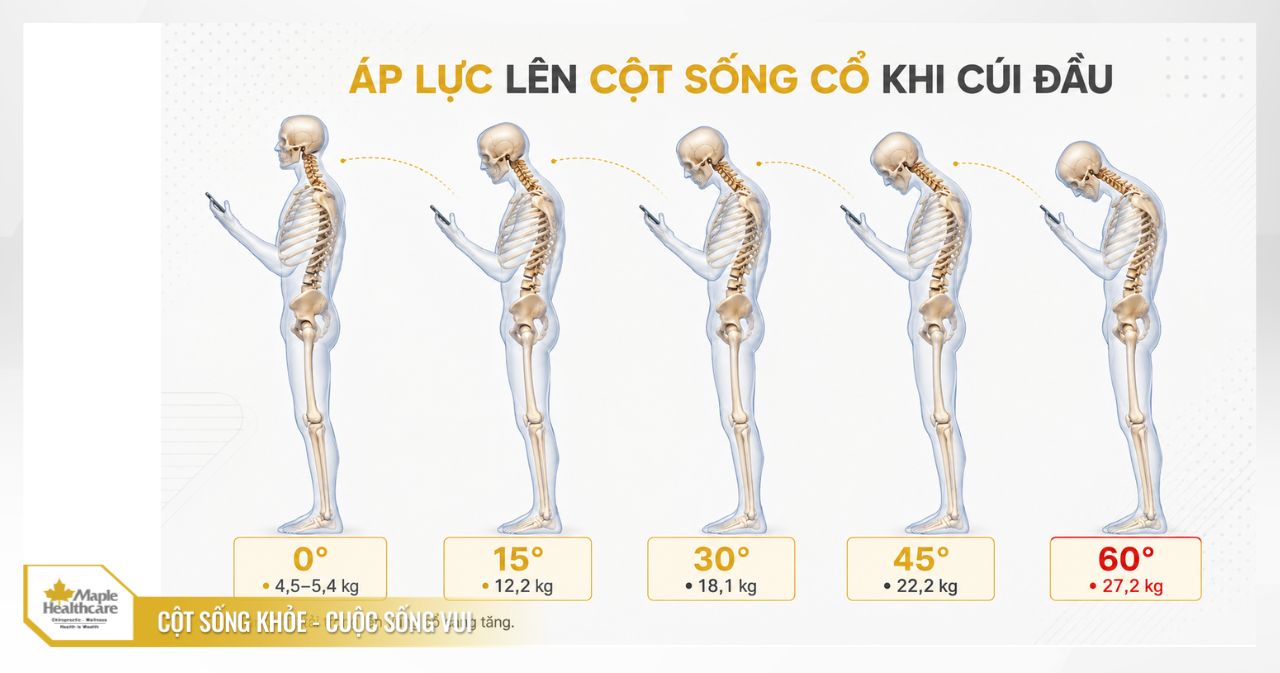 áp lực lên cột sống cổ khi cúi đầu