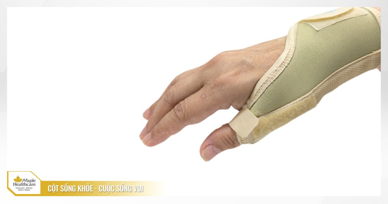 nẹp điều trị viêm gân De Quervain