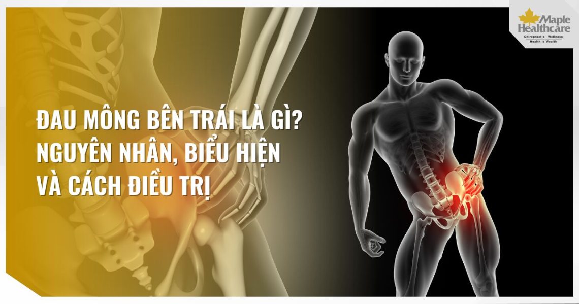 Đau mông bên trái