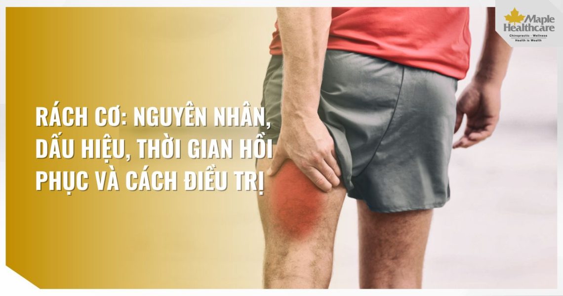 Rách cơ Nguyên nhân, dấu hiệu, thời gian hồi phục và cách điều trị
